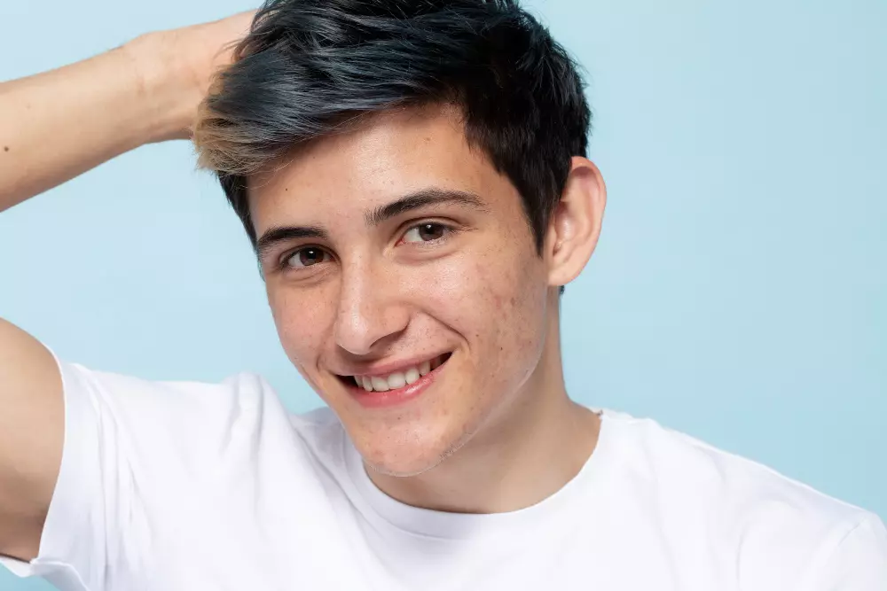 Man receiving laser acne treatment
